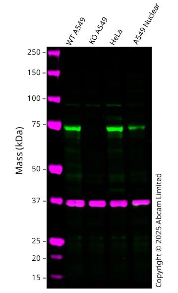 Western blot - Anti-TBC1D15 antibody (AB121396)