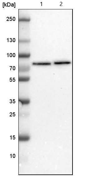 Western blot - Anti-TBC1D15 antibody (AB121396)