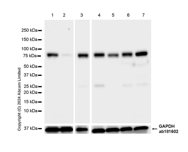 Western blot - Anti-TBC1D15 antibody [EPR29126-76] - BSA and Azide free (AB322058)