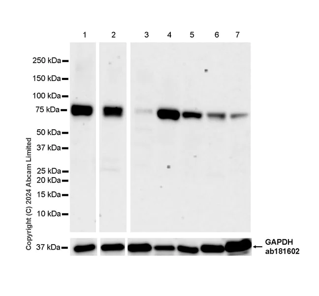 Western blot - Anti-TBC1D15 antibody [EPR29126-76] - BSA and Azide free (AB322058)