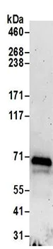 Immunoprecipitation - Anti-TBC1D15 antibody - N-terminal (AB194953)