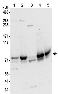 Western blot - Anti-TBC1D15 antibody - N-terminal (AB194953)
