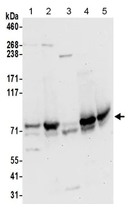 Western blot - Anti-TBC1D15 antibody - N-terminal (AB194953)