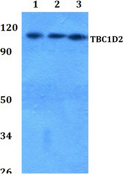 Western blot - Anti-TBC1D2 antibody (AB200692)