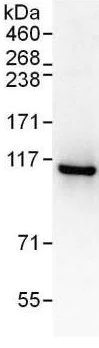 Immunoprecipitation - Anti-TBC1D2 antibody - N-terminal (AB176701)