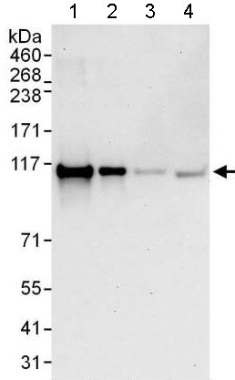 Western blot - Anti-TBC1D2 antibody - N-terminal (AB176701)