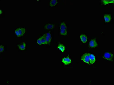 Immunocytochemistry/ Immunofluorescence - Anti-TBC1D20 antibody (AB237685)