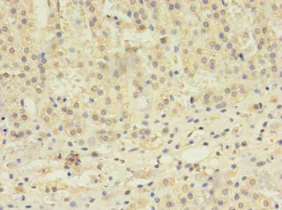 Immunohistochemistry (Formalin/PFA-fixed paraffin-embedded sections) - Anti-TBC1D20 antibody (AB237685)