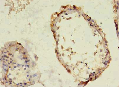 Immunohistochemistry (Formalin/PFA-fixed paraffin-embedded sections) - Anti-TBC1D20 antibody (AB237685)