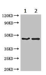 Western blot - Anti-TBC1D20 antibody (AB237685)