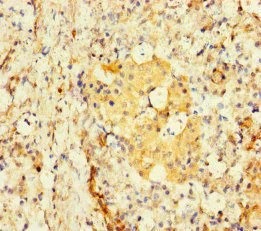 Immunohistochemistry (Formalin/PFA-fixed paraffin-embedded sections) - Anti-TBC1D24 antibody (AB234723)