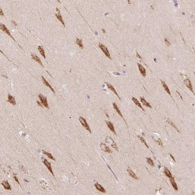 Immunohistochemistry (Formalin/PFA-fixed paraffin-embedded sections) - Anti-TBC1D2B antibody (AB185102)