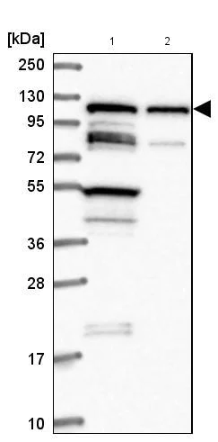 Western blot - Anti-TBC1D2B antibody (AB185102)