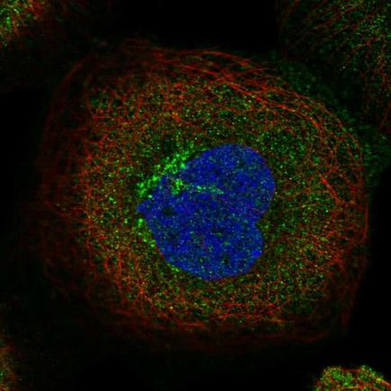 Immunocytochemistry/ Immunofluorescence - Anti-TBC1D5 antibody (AB203896), expandable thumbnail
