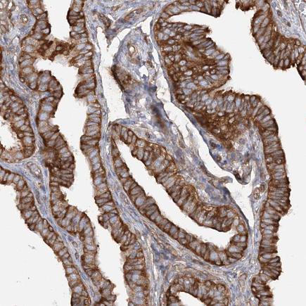Immunohistochemistry (Formalin/PFA-fixed paraffin-embedded sections) - Anti-TBC1D5 antibody (AB203896), expandable thumbnail