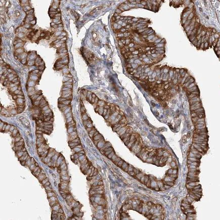 Immunohistochemistry (Formalin/PFA-fixed paraffin-embedded sections) - Anti-TBC1D5 antibody (AB203896)