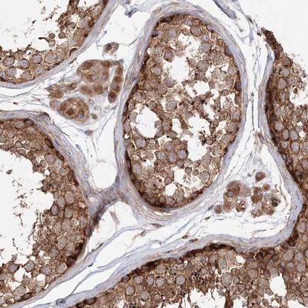 Immunohistochemistry (Formalin/PFA-fixed paraffin-embedded sections) - Anti-TBC1D5 antibody (AB203896), expandable thumbnail