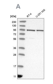 Western blot - Anti-TBC1D5 antibody (AB203896), expandable thumbnail