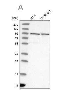 Western blot - Anti-TBC1D5 antibody (AB203896)