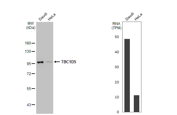 Western blot - Anti-TBC1D5 antibody [HL2054] (AB308578)