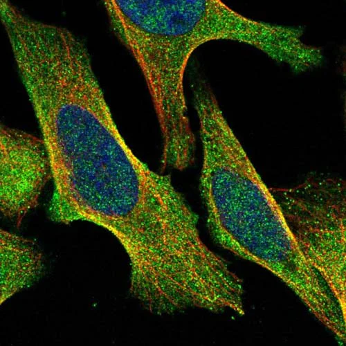Immunocytochemistry/ Immunofluorescence - Anti-TBC1D8B antibody (AB121780)
