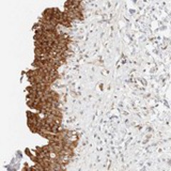 Immunohistochemistry (Formalin/PFA-fixed paraffin-embedded sections) - Anti-TBC1D8B antibody (AB121780)