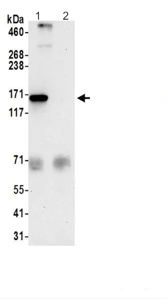 Immunoprecipitation - Anti-TBC1D9B antibody - C-terminal (AB200578)