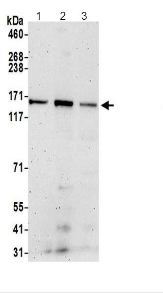 Western blot - Anti-TBC1D9B antibody - C-terminal (AB200578), expandable thumbnail