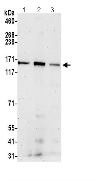 Western blot - Anti-TBC1D9B antibody - C-terminal (AB200578)