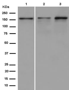 Western blot - Anti-TBC1D9B antibody [EPR12604(2)] - C-terminal (AB187168)
