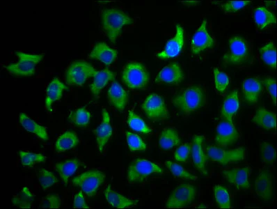 Immunocytochemistry/ Immunofluorescence - Anti-TBCD/SSD1 antibody (AB238761)