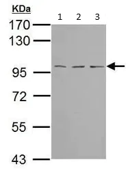 Western blot - Anti-TBCK antibody (AB96188)