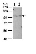 Western blot - Anti-TBCK antibody (AB96188), expandable thumbnail