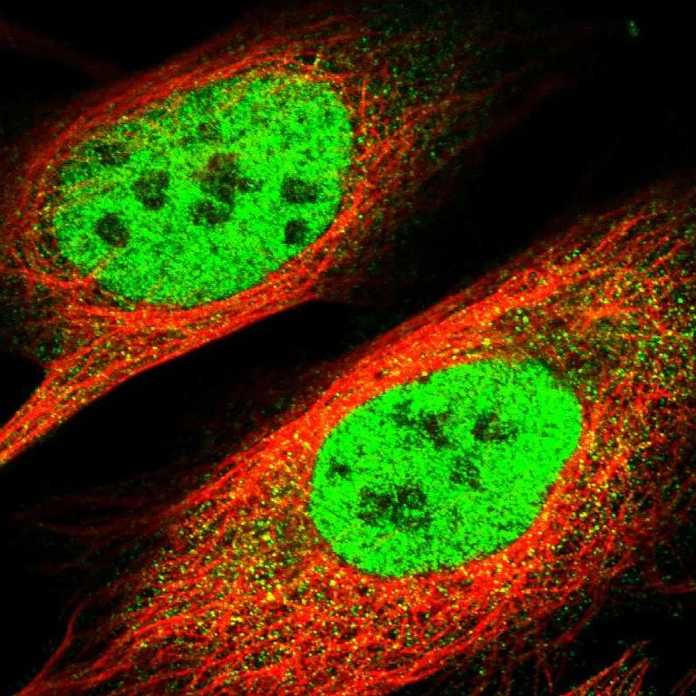 Immunocytochemistry/ Immunofluorescence - Anti-TBL1XR1 Antibody (AB327196)