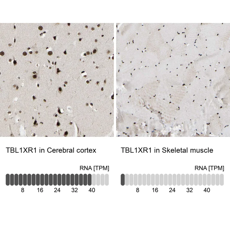 Immunohistochemistry (Formalin/PFA-fixed paraffin-embedded sections) - Anti-TBL1XR1 Antibody (AB327196)