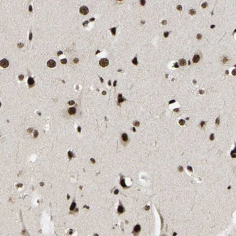 Immunohistochemistry (Formalin/PFA-fixed paraffin-embedded sections) - Anti-TBL1XR1 Antibody (AB327196)