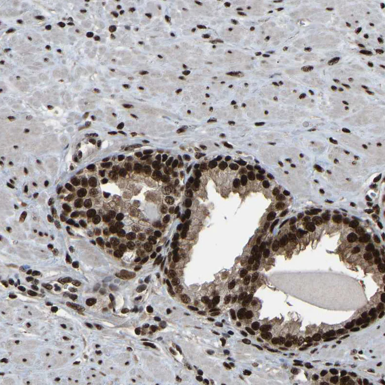 Immunohistochemistry (Formalin/PFA-fixed paraffin-embedded sections) - Anti-TBL1XR1 Antibody (AB327196)