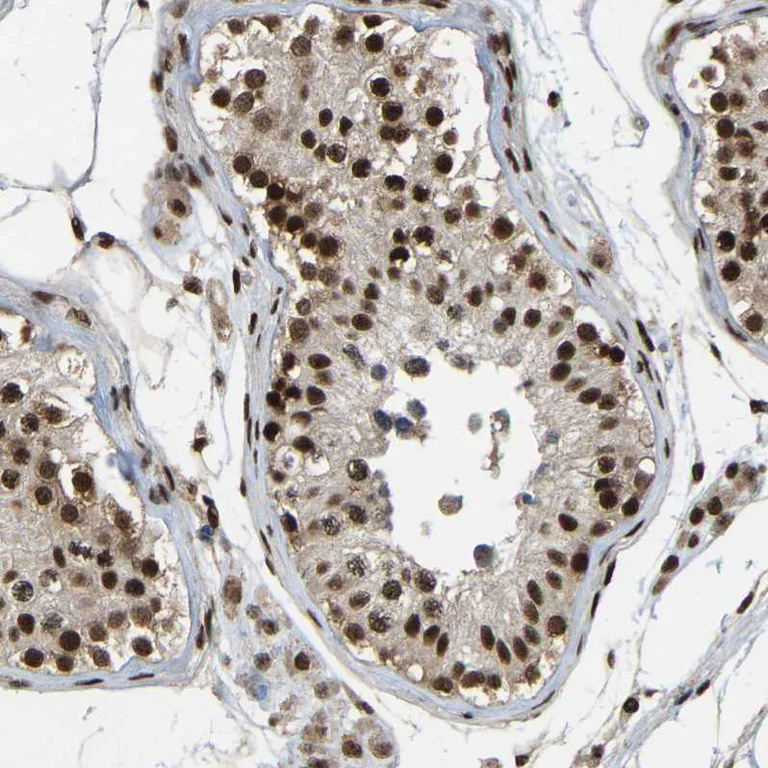 Immunohistochemistry (Formalin/PFA-fixed paraffin-embedded sections) - Anti-TBL1XR1 Antibody (AB327196)