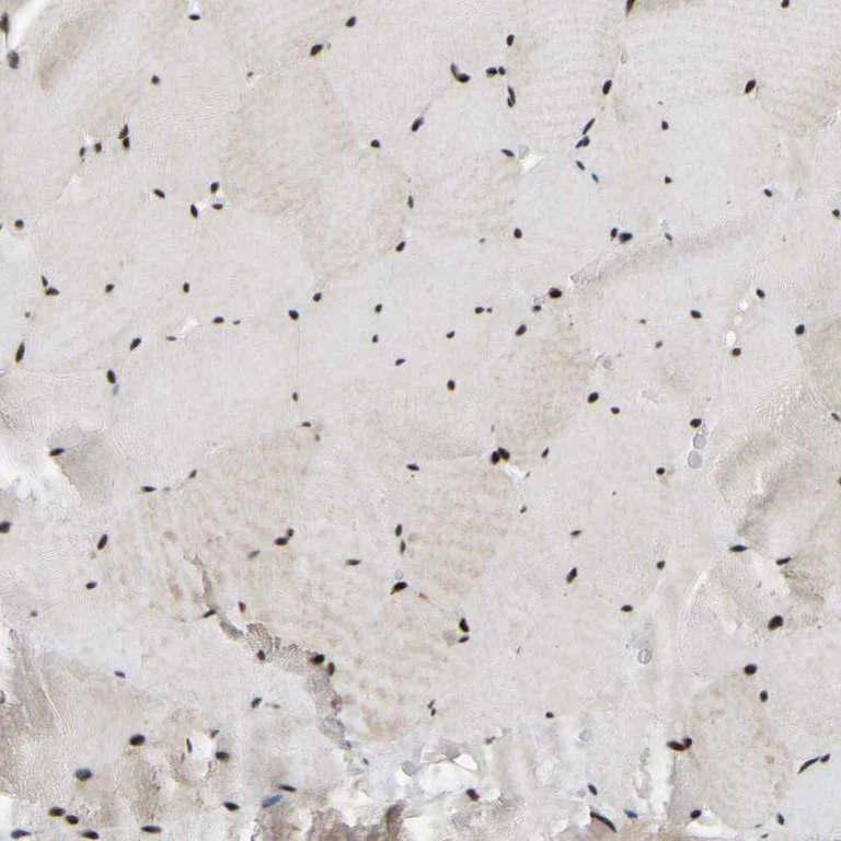 Immunohistochemistry (Formalin/PFA-fixed paraffin-embedded sections) - Anti-TBL1XR1 Antibody (AB327196)