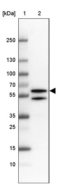 Western blot - Anti-TBL1XR1 Antibody (AB327196)