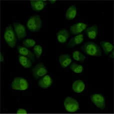 Immunocytochemistry/ Immunofluorescence - Anti-TBLR1/TBL1XR1 antibody [4F3-A8-D9] (AB117761)