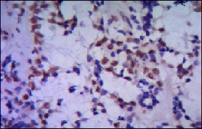 Immunohistochemistry (Formalin/PFA-fixed paraffin-embedded sections) - Anti-TBLR1/TBL1XR1 antibody [4F3-A8-D9] (AB117761)