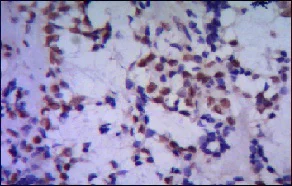 Immunohistochemistry (Formalin/PFA-fixed paraffin-embedded sections) - Anti-TBLR1/TBL1XR1 antibody [4F3-A8-D9] (AB117761)