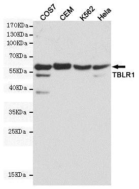 Western blot - Anti-TBLR1/TBL1XR1 antibody [4F3-A8-D9] (AB117761)