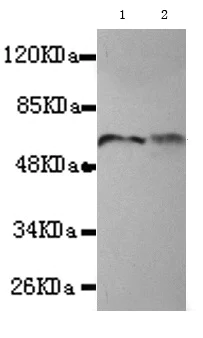 Western blot - Anti-TBLR1/TBL1XR1 antibody [4F3-A8-D9] (AB117761)