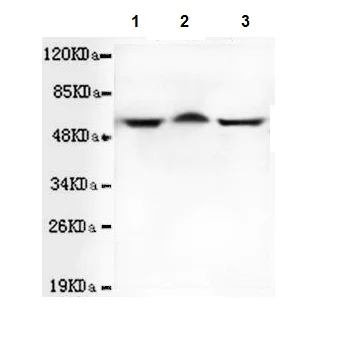Western blot - Anti-TBLR1/TBL1XR1 antibody [4F3-A8-D9] (AB117761)