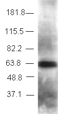 Western blot - Anti-TBLR1/TBL1XR1 antibody (AB24550)