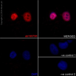 Immunocytochemistry/ Immunofluorescence - Anti-TBLR1/TBL1XR1+TBL1X+TBL1Y antibody [EPR16153] (ab190796), expandable thumbnail