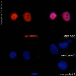 Immunocytochemistry/ Immunofluorescence - Anti-TBLR1/TBL1XR1+TBL1X+TBL1Y antibody [EPR16153] (AB190796)