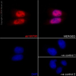 Immunocytochemistry/ Immunofluorescence - Anti-TBLR1/TBL1XR1+TBL1X+TBL1Y antibody [EPR16153] (AB190796), expandable thumbnail